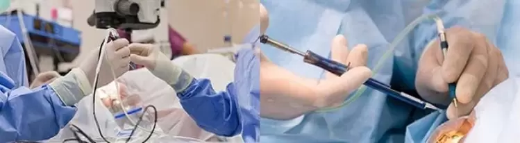 Cirurgia para restaurar a visão